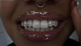 Pearl white teeth + attractive smile in 30 seconds 💉✨
