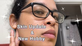 Skin Update & New Hobby | Curly Cami Channel 