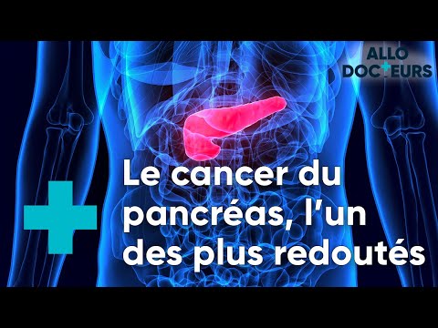Cancer du pancréas, quels progrès  - Le Magazine de la Santé