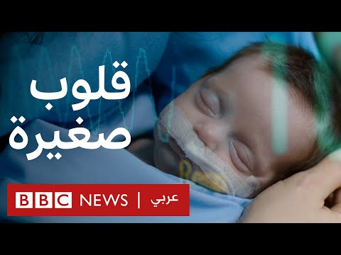 Beating Hearts: Beirut’s haven for sick babies