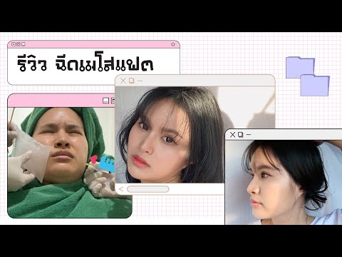 เมโสแฟต ยี่ห้อไหนดี