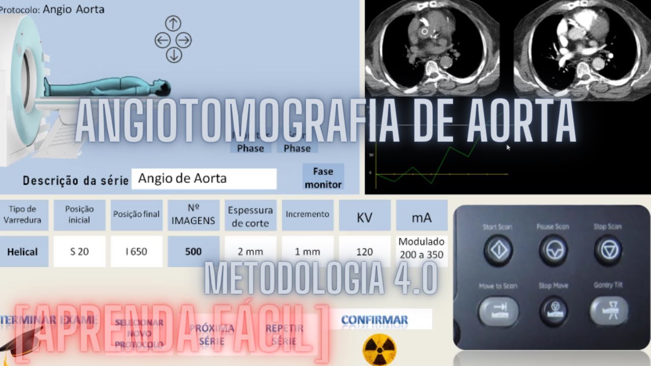 [APRENDA FÁCIL]  ANGIOTOMOGRAFIA DE AORTA