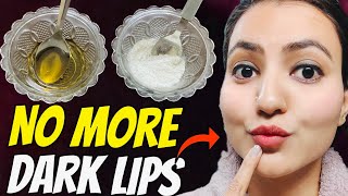 Get Rid of DRY DARK CHAPPED & PIGMENTED LIPS in Just 3 Days | Get PINK SOFT LIPS Naturally💕