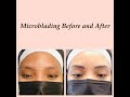 Difference Between Eyebrow Lamination And Microblading