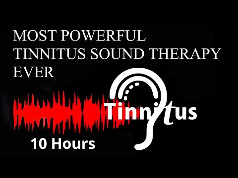MOST POWERFUL TINNITUS SOUND THERAPY EVER Tinnitus Treatment Ringing in ears Tinnitus Masking Sounds