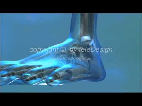 Was ist Arthrose kantenWirbelGelenke Heilanstalt Behandlung von Hernien der Halswirbelsäule