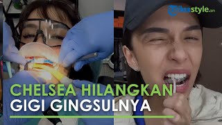 Chelsea Olivia Hilangkan Gigi Gingsulnya, Tak Lagi Jadi Ciri Khas, Kena Banyak Protes dari Fans