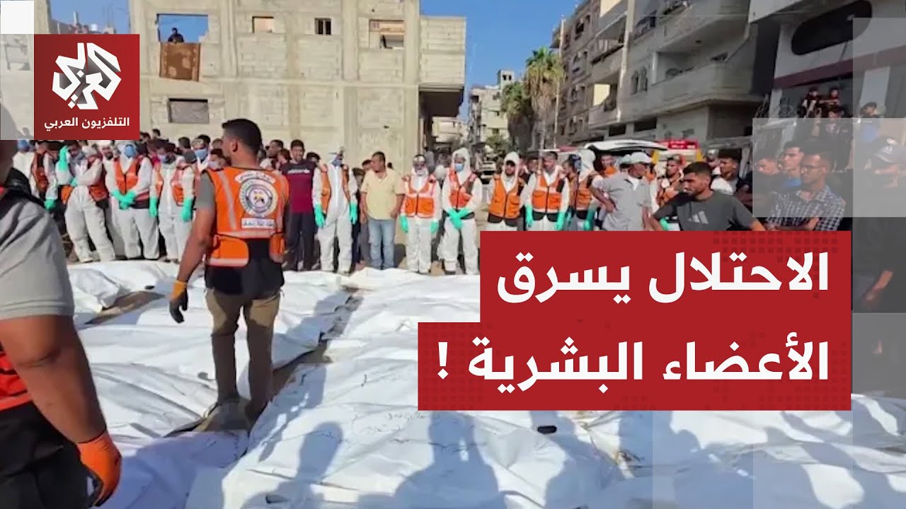 أشلاء ذائبة.. جثامين شهداء دون ملامح تكشف تورط الاحتلال في التعذيب وسرقة الأع