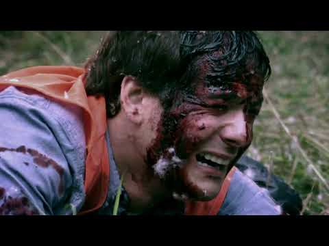 Teen Survives Brutal Grizzly Bear Attack Montana