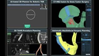 AlgoSurg Inc's 2024 Technological Milestones!