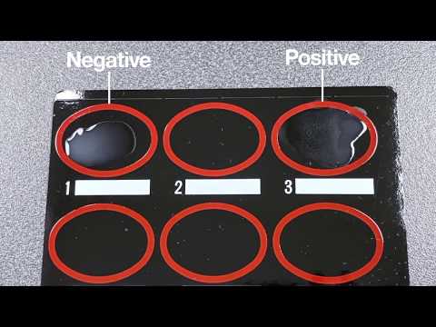 Manual D-Dimer from Helena Biosciences