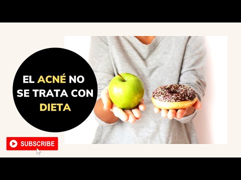 El acné NO se trata con DIETA