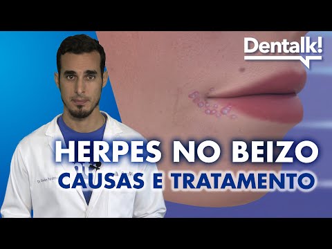 Vídeo: Herpes no beizo. Tratamento, causas e síntomas