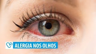 Alergia nos olhos