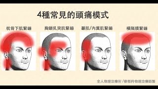 [問題] 詢問頭痛推薦醫師