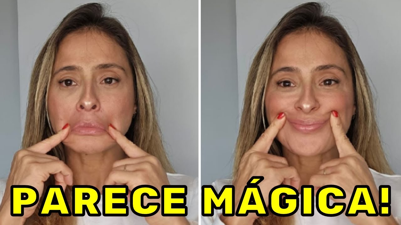 Linhas ou Rugas de Marionete? FAÇA JÁ e Acabe com isso!