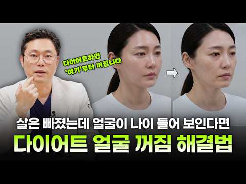 살 빼고 얼굴 꺼짐, 오히려 늙어 보인다면? 다이어트볼살빠짐과 처짐을 함께 봐야 합니다ㅣ다이어트얼굴처짐ㅣ디에이성형외과