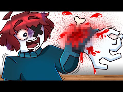 Mis Accidentes más DOLOROSOS 🤕🩸