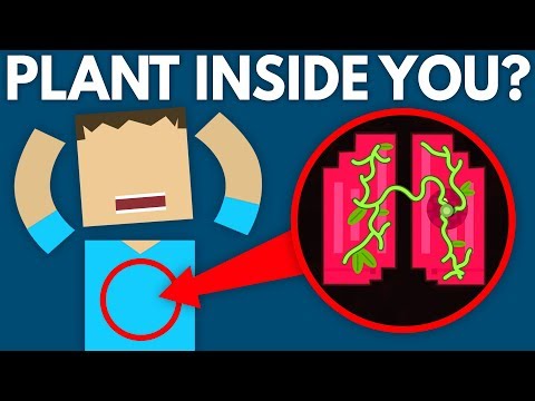 植物はあなたの中で育つのでしょうか？ (Could A Plant Grow Inside You?)