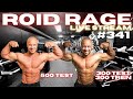 ROID RAGE LIVESTREAM Q&A 341: 500 TEST VS 300 TEST 300 TREN