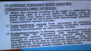 Dr.Sahar - Neoplasia 4 - part 2 " Routs of tumor spread "