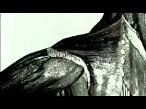 Mystery Diagnosis - FOP Part 1