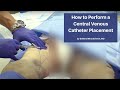 How to Perform a Central Venous Catheter Placement | The Cadaver-Based EM Procedures Online Course