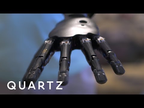 The Man with a Mind-Controlled Robot Arm