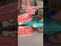 ICE CREAM FRUIT ROLL UPS VS BRACES ORTHODONTIST TRIES REACTS IS IT SAFE FOR BRACES Shorts