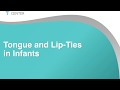 Tongue-Ties & Babies Presentation for Parents - Alabama Tongue-Tie Center