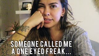 i&#39;m a one-eyed freak?! | thezomebielife