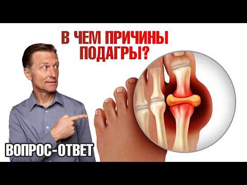 Приступы подагры. Альтернативный взгляд на причины подагры🧐 Приступы подагры. Альтернативный взгляд на причины подагры🧐