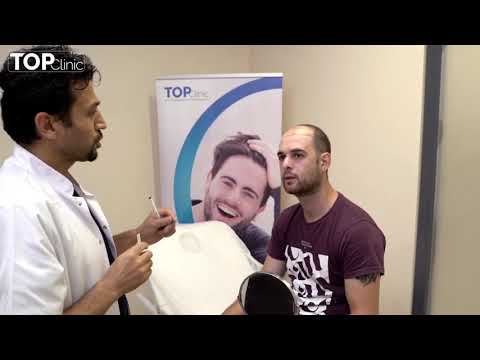 Gorgi - Experiences in the Hair transplant in Turkey