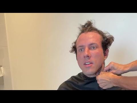 Zu viel Stress: Christian Wolf brauchte Haartransplantation!