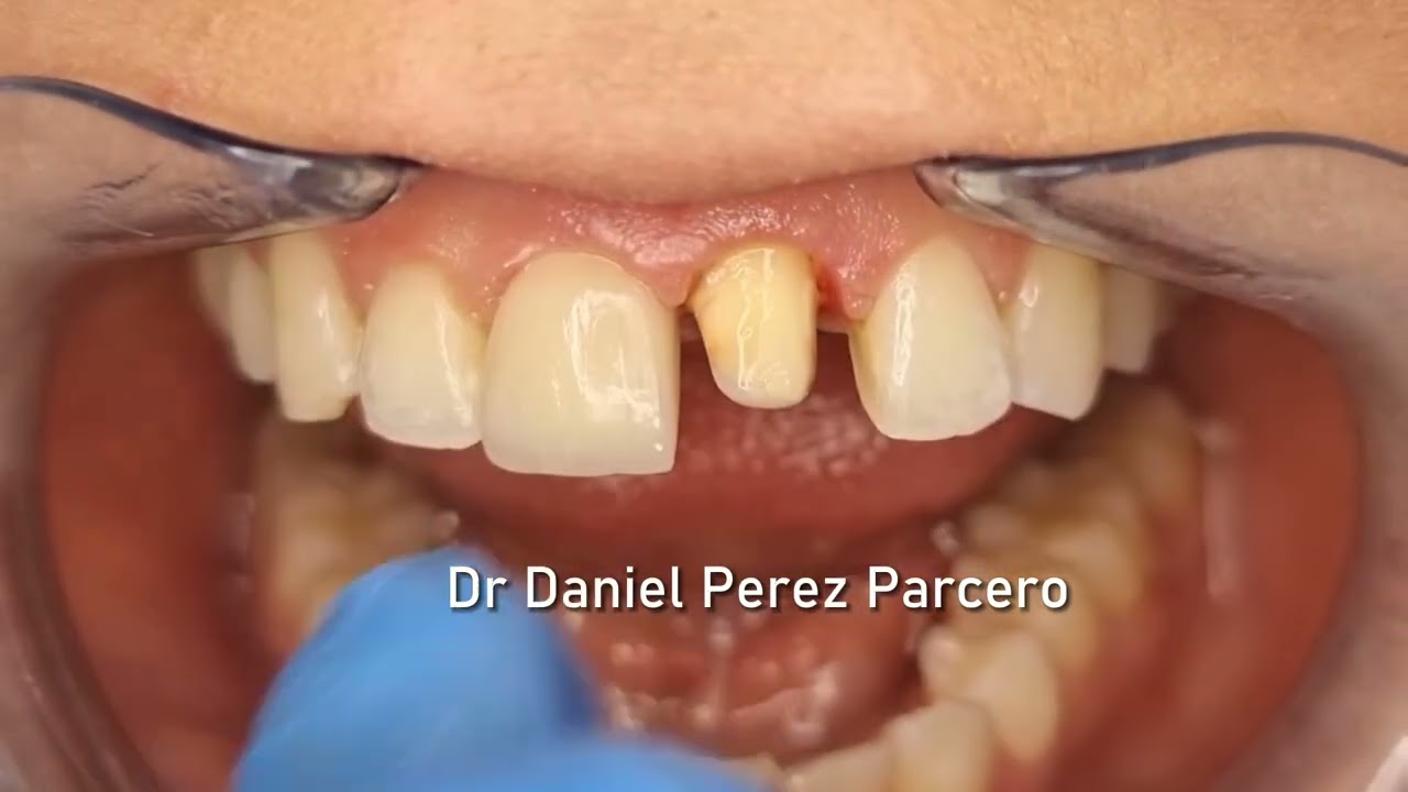 Daniel Perez Parcero-18