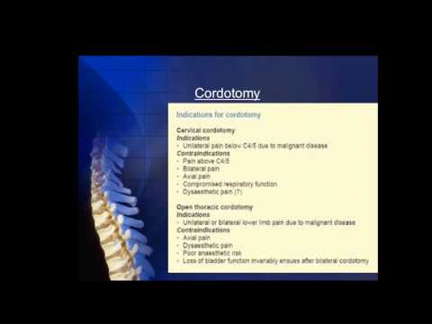 SIR-RFS Webinar (7/30/14): Advanced Interventional Treatments for Cancer Pain