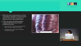 Alopecia Ferropénica. Dra. Belma Ramírez