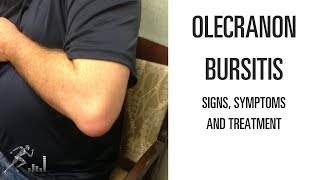 Olecranon bursitis: Signs, symptoms and treatment of the elbow problem