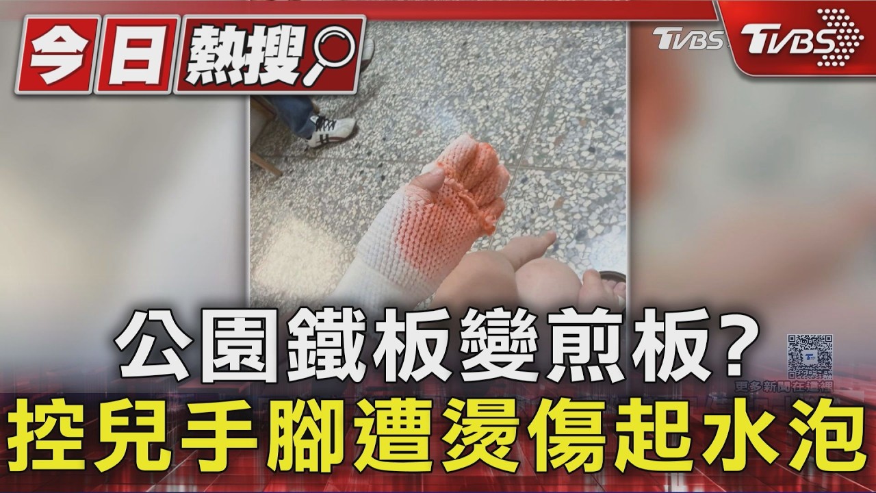 公園鐵板變煎板?控兒手腳遭燙傷起水泡|TVBS新聞 @TVBSNEWS01