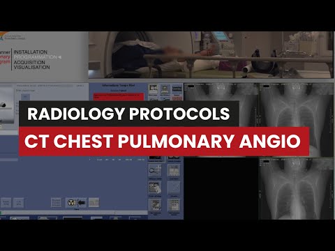 Pulmonary Angiography CT Protocol: A Guide for Rad Techs