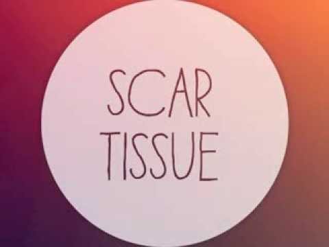 NTO - Scar Tissue