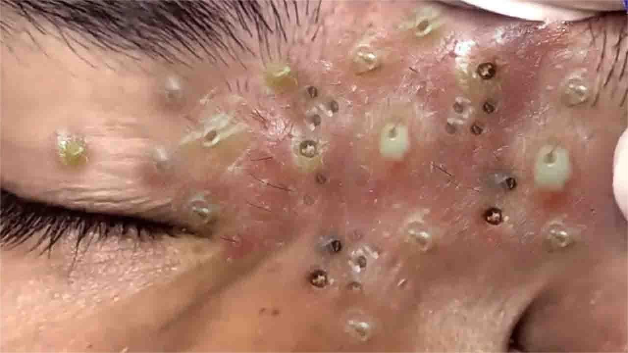 𝑺𝒐𝒐𝒕𝒉𝒊𝒏𝒈 𝑭𝒂𝒄𝒊𝒂𝒍 𝑻𝒓𝒆𝒂𝒕𝒎𝒆𝒏𝒕 𝑭𝒐𝒓 𝑺𝒕𝒓𝒆𝒔𝒔 𝑹𝒆𝒍𝒊𝒆𝒇 𝒂𝒕 𝑳𝒖𝒙𝒖𝒓𝒚 𝑺𝒑𝒂 𝑨𝒄𝒉𝒊𝒆𝒗𝒆 𝑰𝒏𝒏𝒆𝒓 𝑷𝒆𝒂𝒄𝒆 #5001205