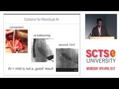 TAVI complication management