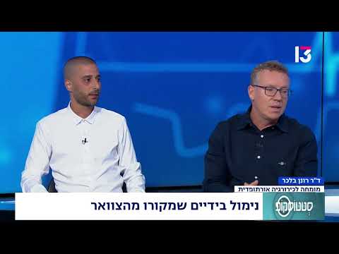  נימול בידיים שמקורו מהצוואר