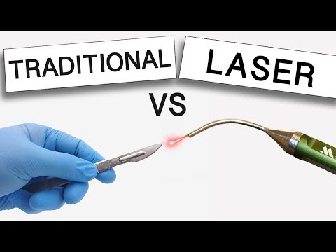 What's Best for Gum Disease Treatment? Surgery V.S. Laser