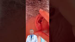 Movimenta a orelha assim… que alívio! 😱👂 #shorts