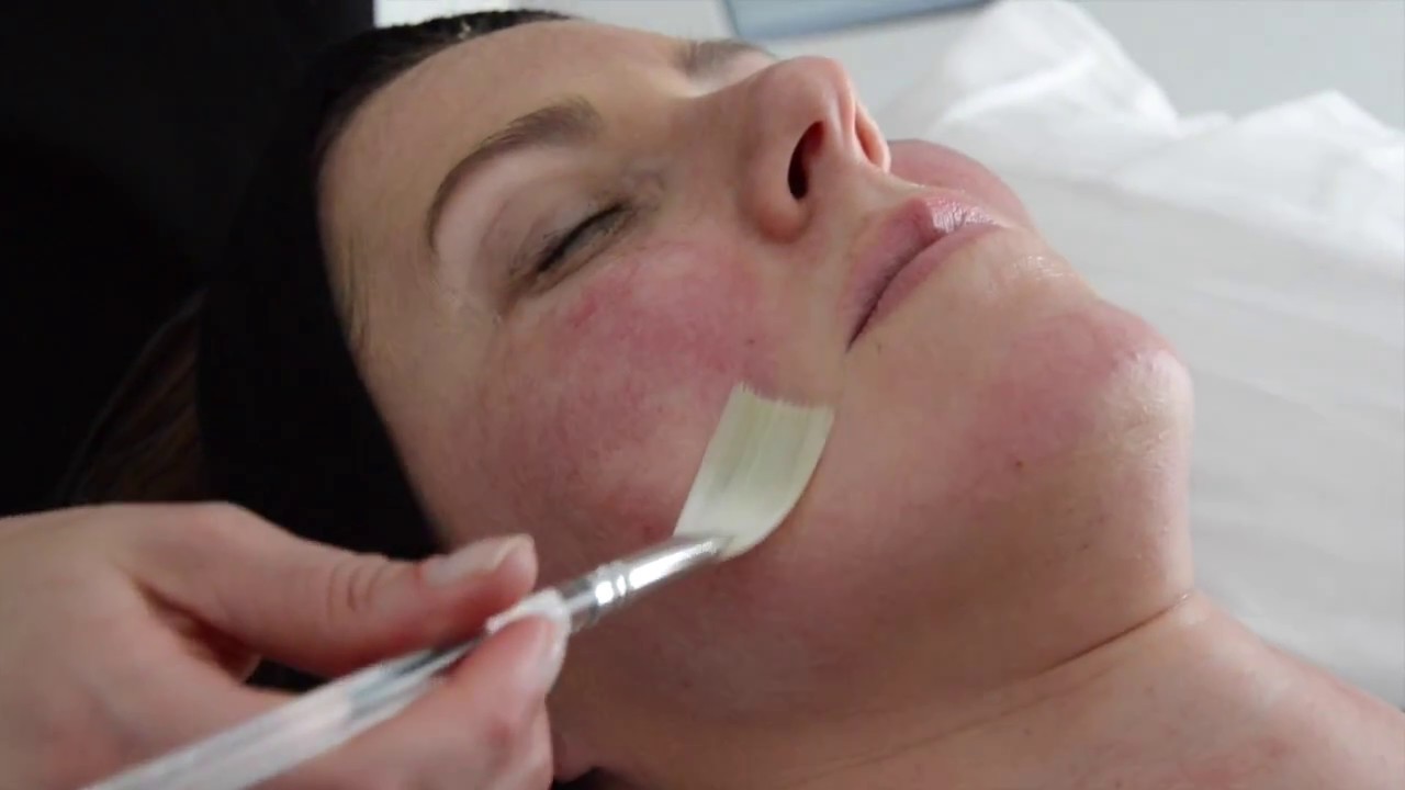 SkinCeuticals Phyto Corrective Masque Applied Post-IPL Laser
