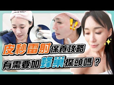 「皮秒」VS「蜂巢皮秒」差在哪？選對療程，把錢花在刀口上！