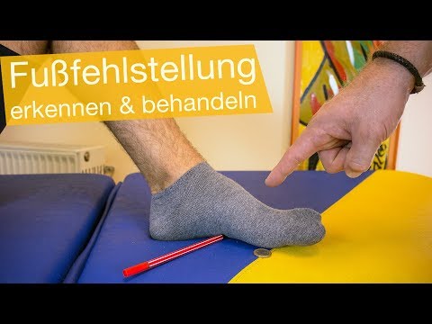 Fußfehlstellung erkennen & korrigieren (Übungen) 👣Knickfuß, Senkfuß, Spreizfuß