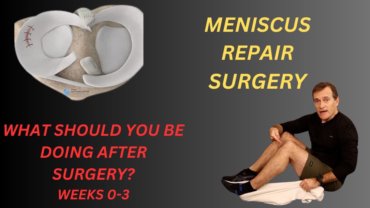 WHAT EXERCISES SHOULD YOU BE DOING AFTER MENISCUS REPAIR SURGERY? POST OP WEEKS 0-3